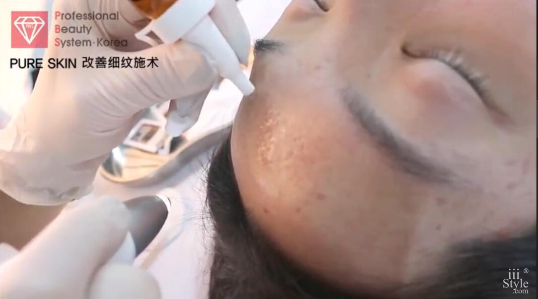 Korea professional beauty system pure skin skin patches freckles liver spot performance