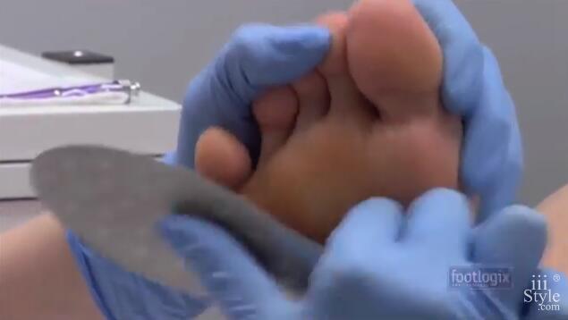 Footlogix 18 Stainless Steel Foot File How to remove callus on feet