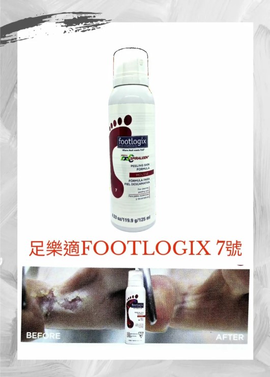 Footlogix 7 Peeling Skin Formula with DIT 125ml/4.23oz