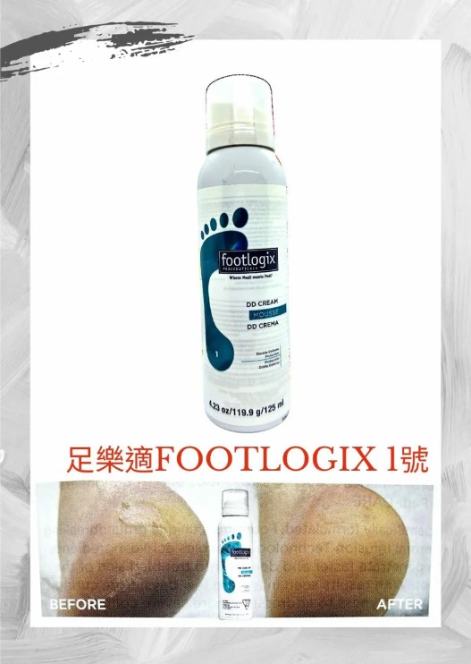 Footlogix 足樂適 1 雙效防護DD慕斯 119.9g/4.23oz